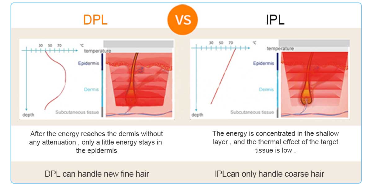 DPL Laser of Manufactuers