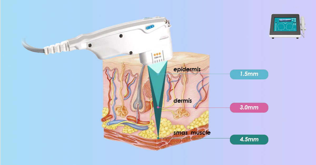 Machine Hifu