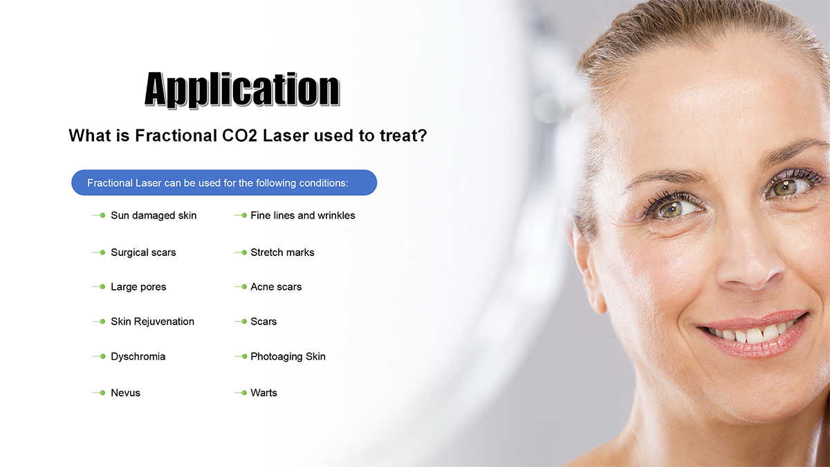 best-fractional-co2-laser-machine best-fractional-co2-laser-machine