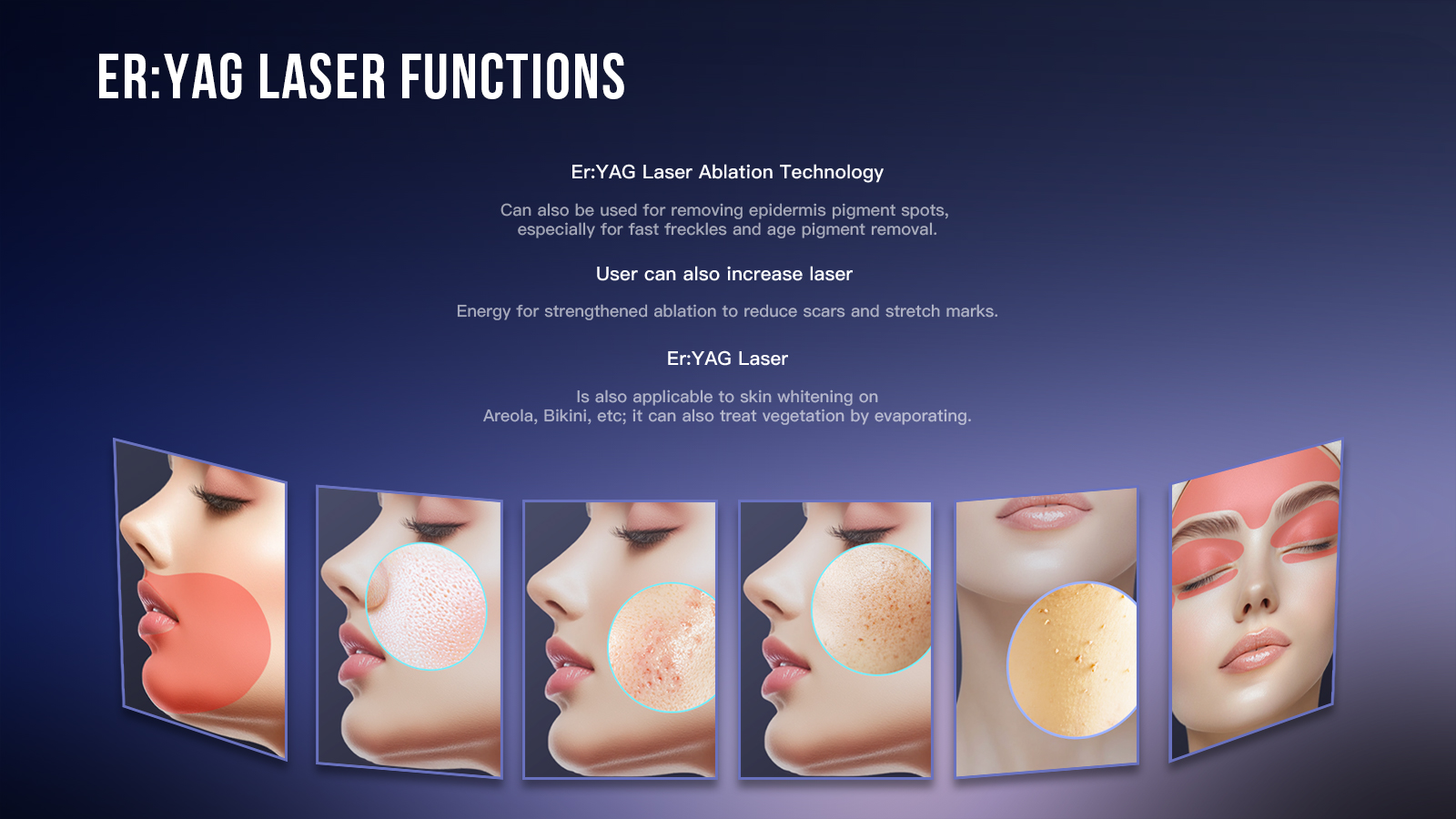 2940nm Erbium Yag Laser machine.jpg 2940nm Erbium Yag Laser machine.jpg